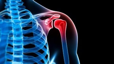 patologia de hombro Ab fisioterapia